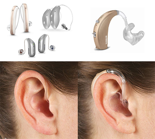 Receiver-in-canal (RIC) and behind-the-ear (BTE) hearing aids – over-the-ear devices with external components